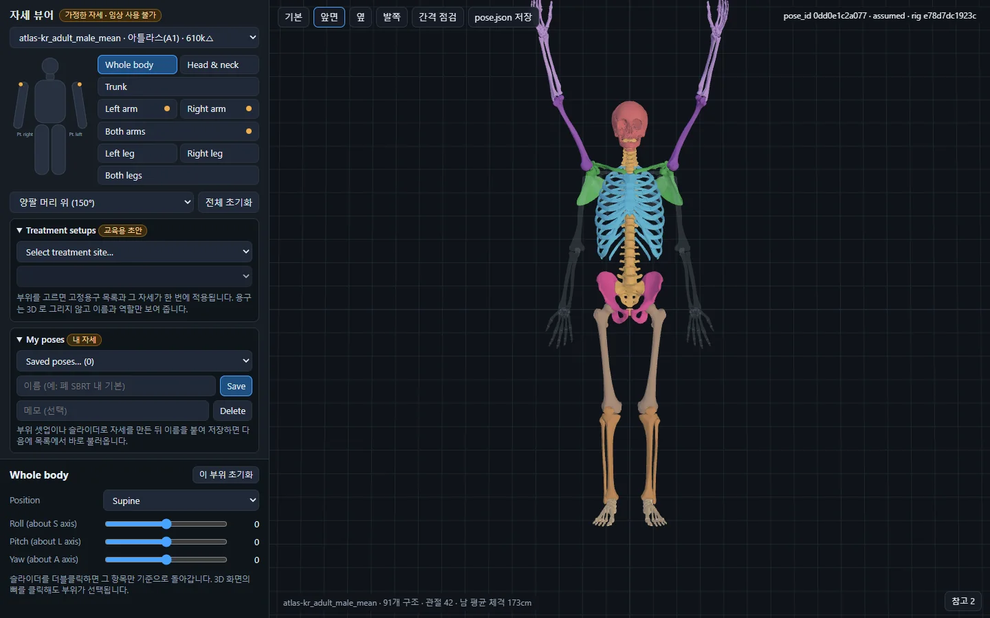 양팔 머리 위 150° — 앞면 시점