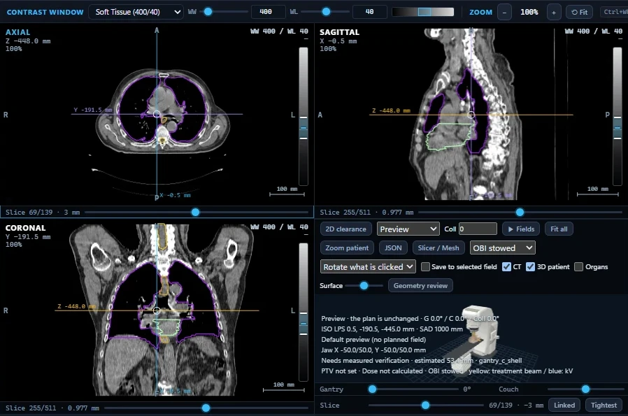 BeamTPS screenshot